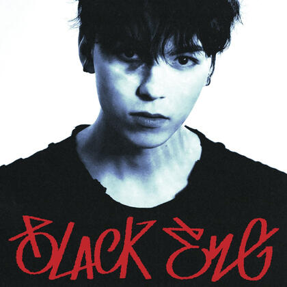 black eye